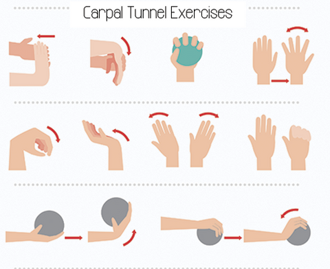 Carpal Tunnel Syndrome: Remedies & Exercises