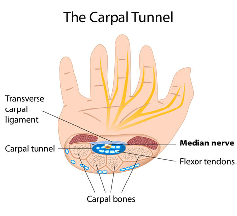 Carpal Tunnel Syndrome FAQ