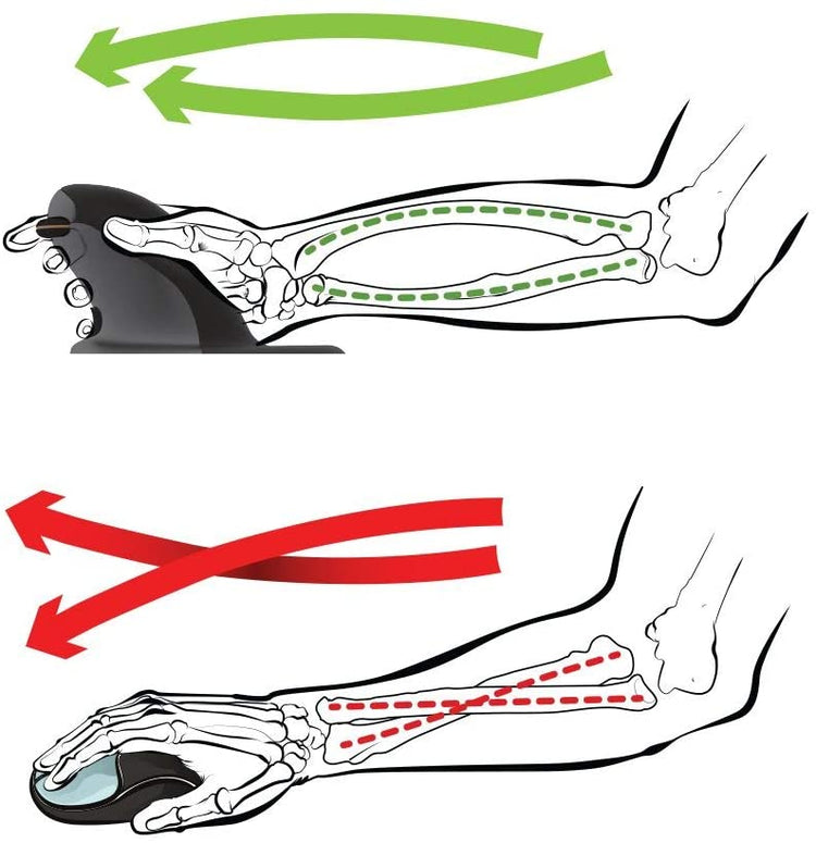 Penguin 3-in-1 ambidextrous vertical mouse for left and right hand - wrist pain and RSI relief diagram